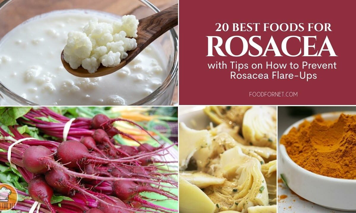 20 Best Foods for Rosacea with Tips on How to Prevent Rosacea Flare-Ups featured image