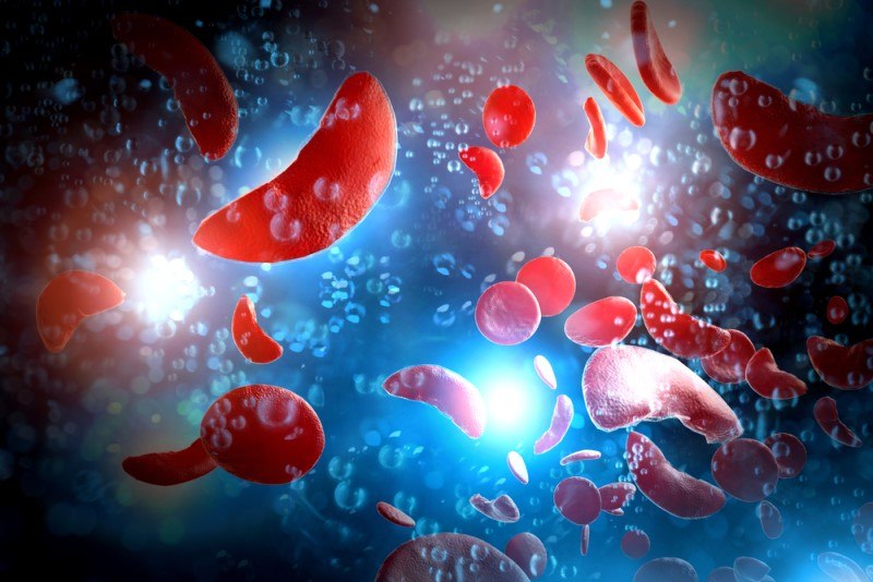 Best Foods Anemia | Food For Net This photo shows red sickle cell blood cells and normal red blood cells floating in clear liquid in front of some white lights, representing the best foods to eat for anemia.