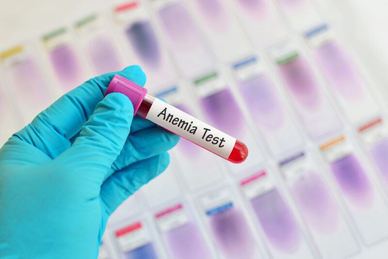 Blood,Sample,For,Anemia,Testing | Food For Net A hand in a blue glove holds a test tube with a purple top and white label reading 'anemia test,' representing the best foods for low iron.
