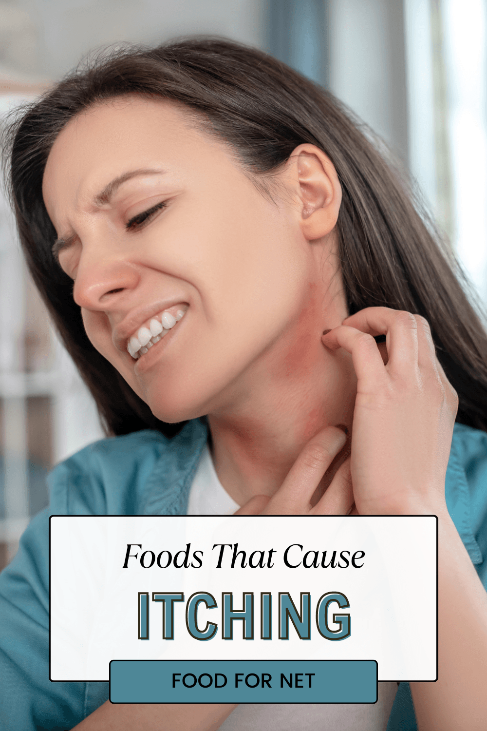 A woman in a blue shirt scratching her neck, highlighting the idea of foods that cause itching