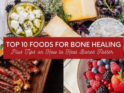 Top 10 Foods For Bone Healing Plus Tips on How to Heal Bones Faster featured image